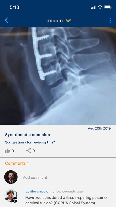 Screenshot #1 pour ACES – Cervical Fusion Forum