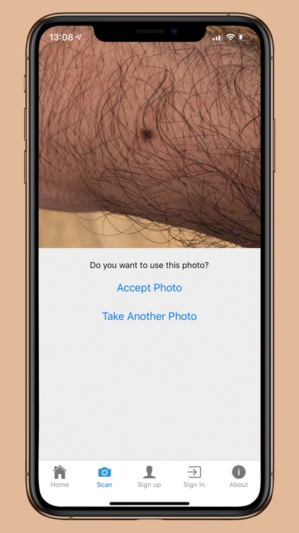 DermoScanner