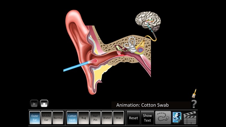 Ear Disorders: Outer Middle