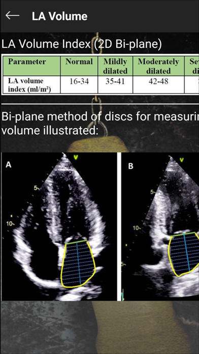 Echocompanion screenshot 3