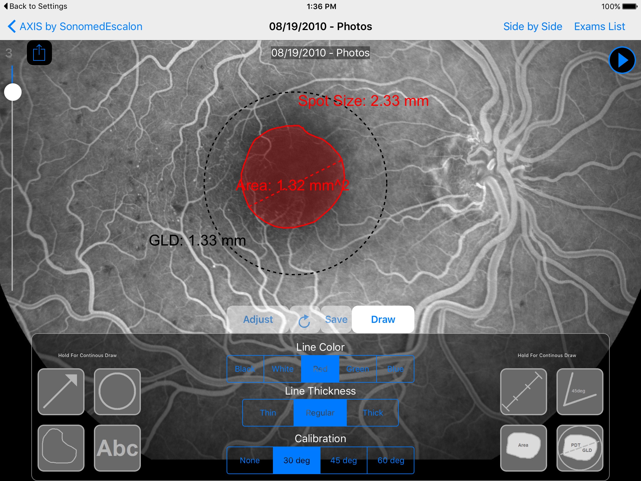 SonomedEscalon Axis screenshot 3