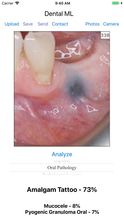 Dental ML screenshot-4