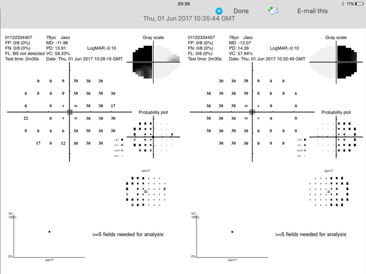 MRF Neural Lite
