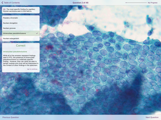 Thyroid Pathology(圖5)-速報App