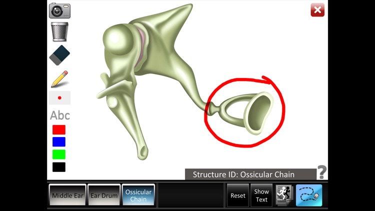 Middle Ear ID screenshot-3