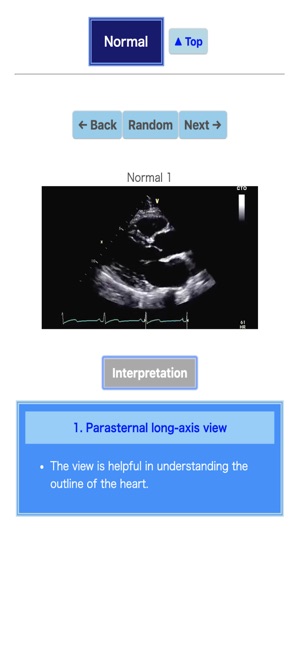 Pocket Heart Echo(圖2)-速報App