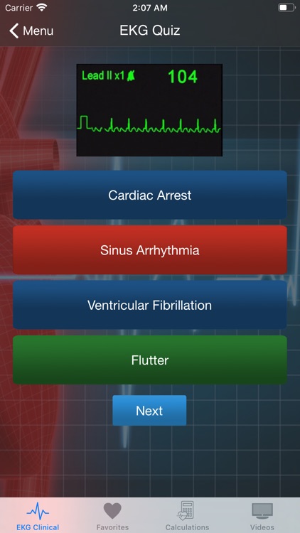 EKG Clinical