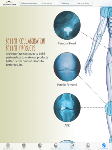 Arthrosurface Resource screenshot 2
