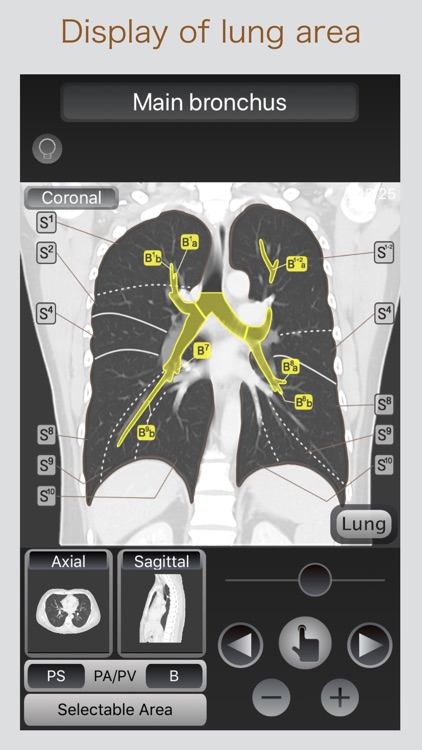 CT Passport Chest