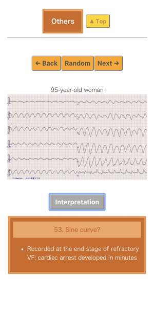 Pocket ECG(圖6)-速報App