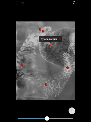 Imágen 10 MedImaging-Radiology Made Easy iphone