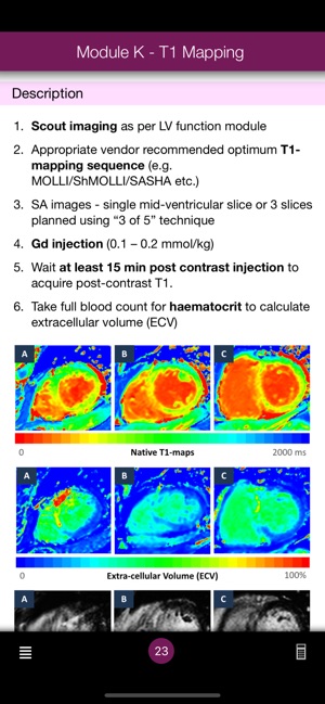 CMR Pocket Guide(圖4)-速報App