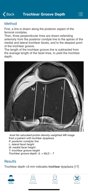 Radiology Measurements(圖3)-速報App