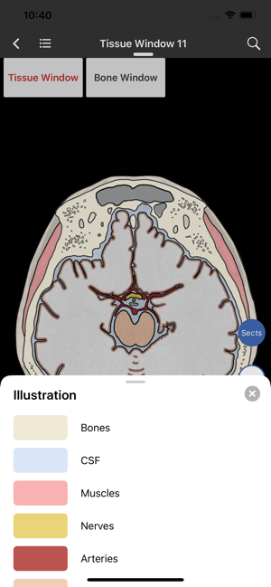 MedImaging-Radiology Made Easy(圖4)-速報App