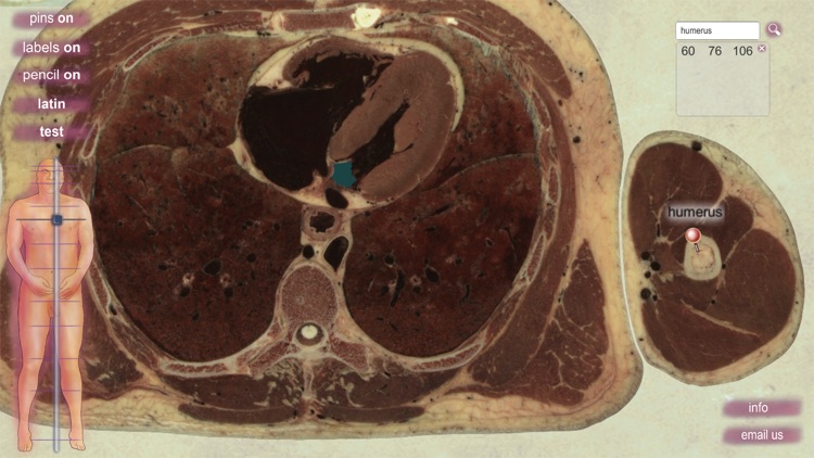 sAnatomy