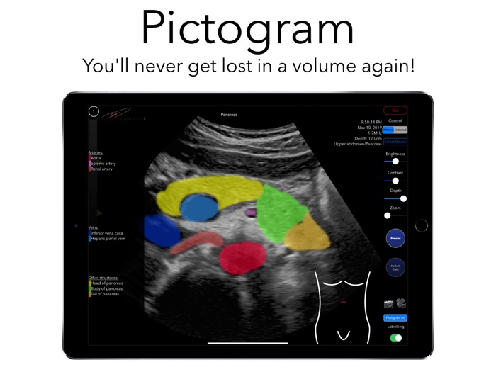 Scanbooster Ultrasound Sim
