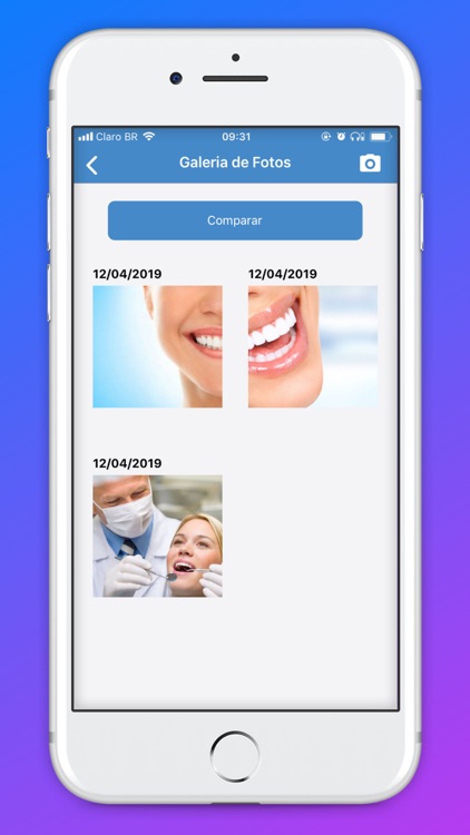 Esthetic Aligner screenshot-3