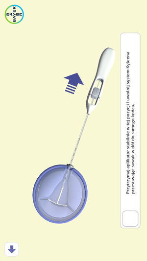 IUS Insertion(圖9)-速報App