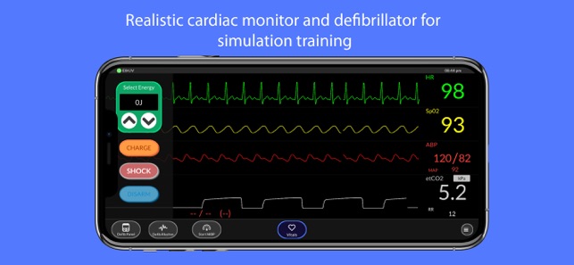 Simpl Patient Monitor(圖1)-速報App