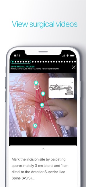 Touch Surgery(圖6)-速報App