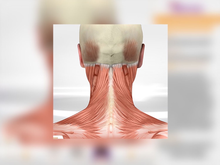 Chronic Migraine Anatomy