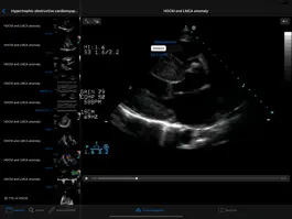 Game screenshot CARDIO3®Echocardiography HD mod apk