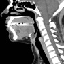 Get CT Neck for iOS, iPhone, iPad Aso Report