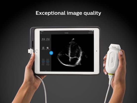 Philips Lumify Ultrasoundのおすすめ画像2