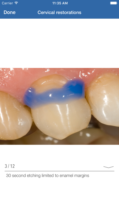 Dental Composite screenshot 3