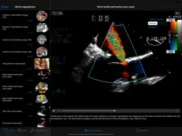 Game screenshot CARDIO3®Echocardiography HD hack