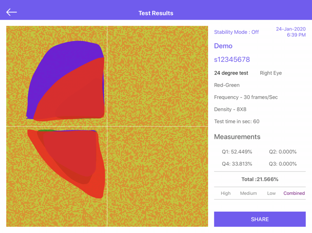 Visual Field Fast Pro(圖4)-速報App