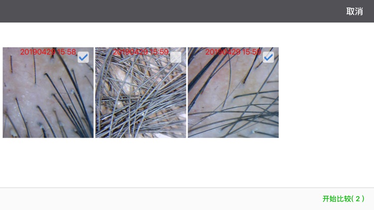 头皮毛发检测-新生活 screenshot-3