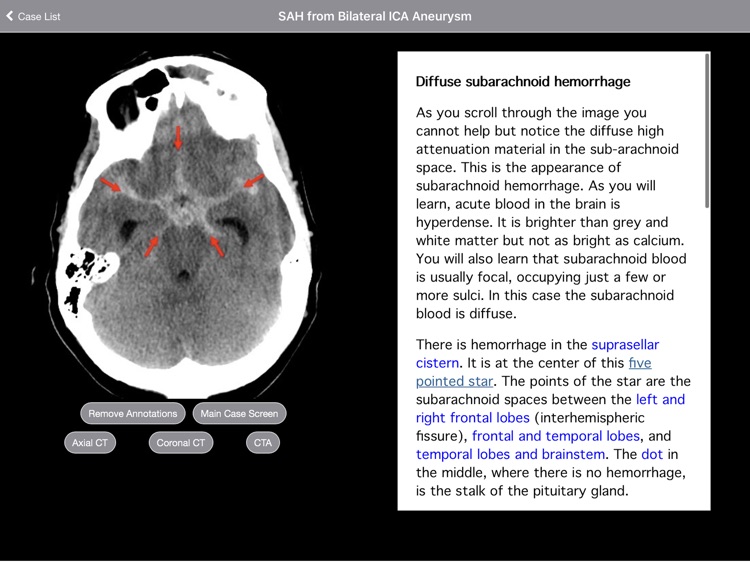 Radiology 2.0: Head CTs screenshot-3