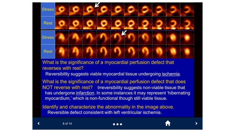 Basic Radiology - SecondLook screenshot-4