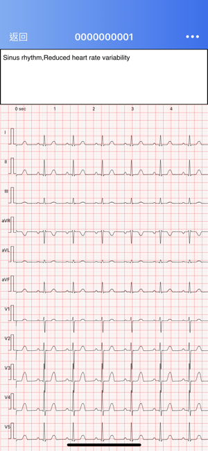 CaRDIaRT ECG(圖4)-速報App