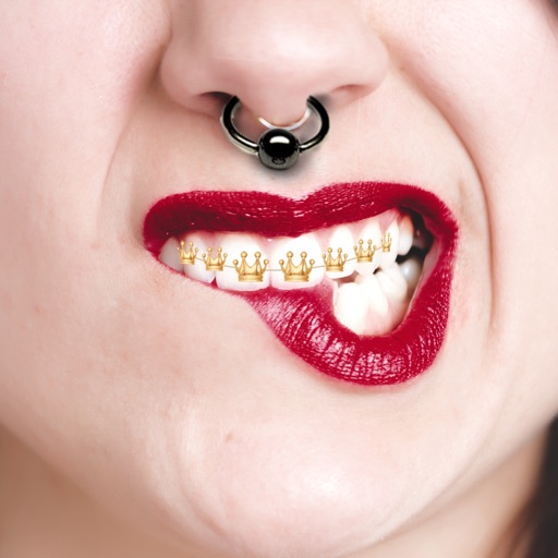 Piercing - Teeth Braces on Fac