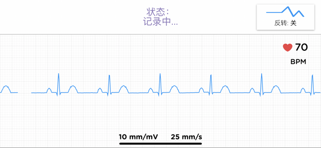 Vitals Monitor-ECG Research(圖3)-速報App