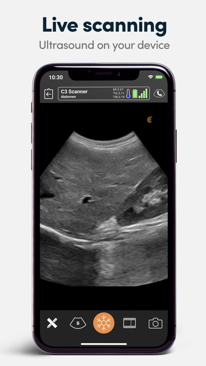 Clarius Ultrasound App screenshot-0