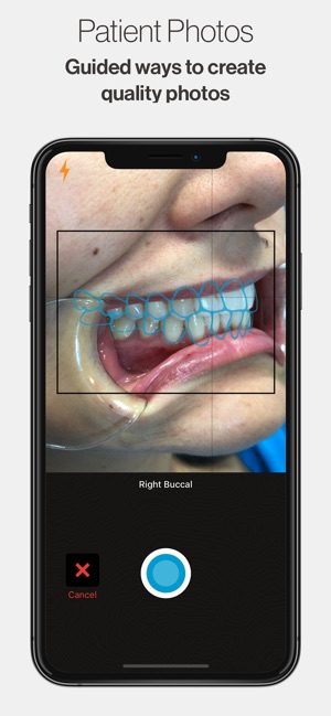 Invisalign Photo Uploader(圖3)-速報App