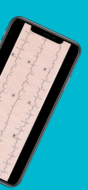 12 Lead ECG Challenge截图