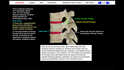 How to cancel & delete Human Skeleton: Gross Anatomy from iphone & ipad 2