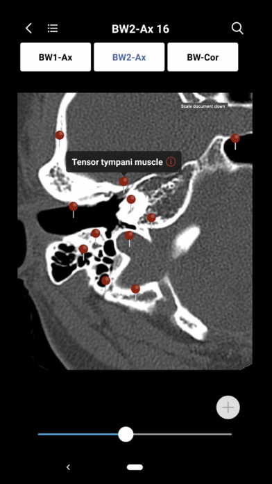 MedImaging-Radiology Made Easy screenshot 4