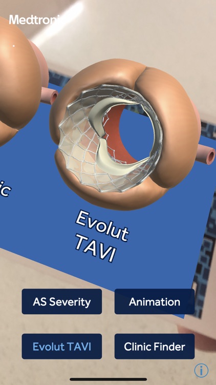 Aortic Stenosis Evolut™ TAVI