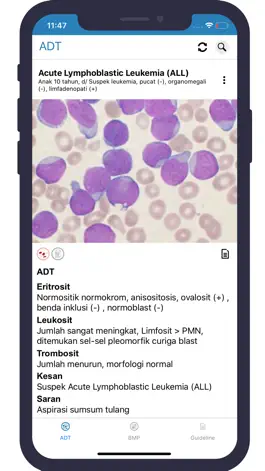 Game screenshot Microscopic Haematology apk