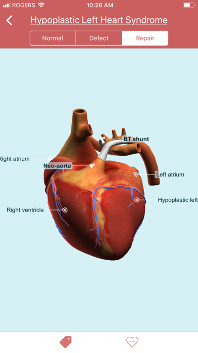 How to cancel & delete eMurmur Heartpedia from iphone & ipad 3