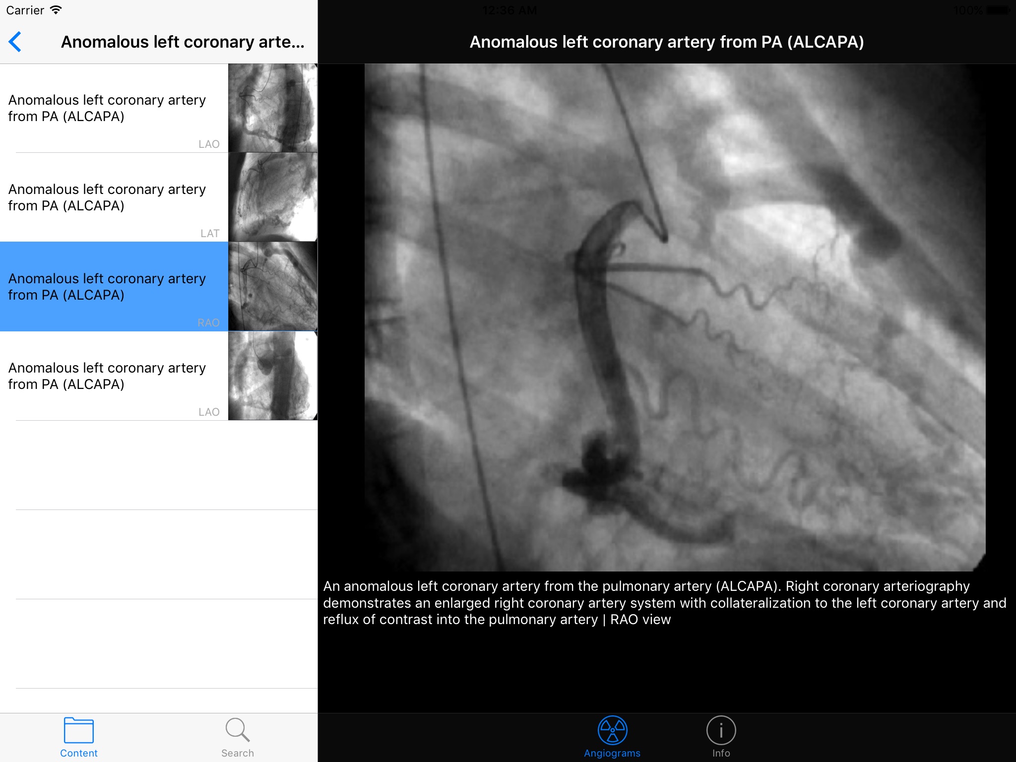 CARDIO3®Invasive Cardiology HD screenshot 3