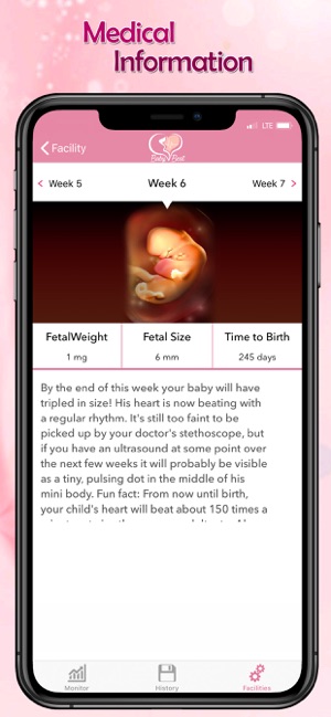 BabyHeartBeat Fetal Monitoring(圖6)-速報App