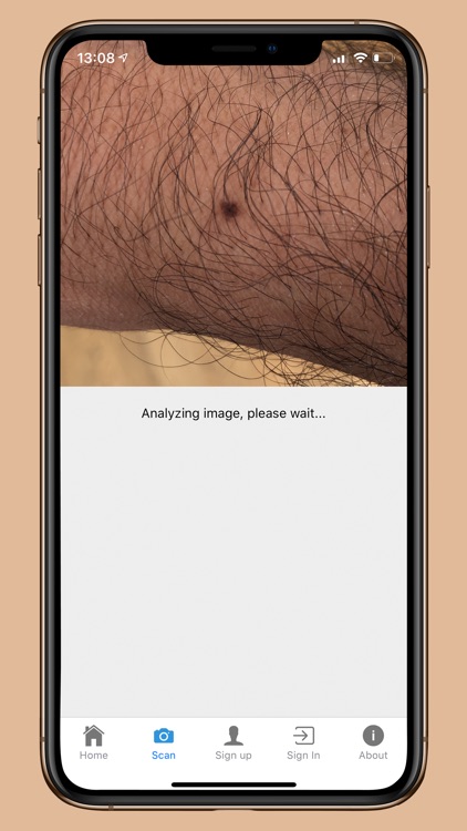 DermoScanner screenshot-5