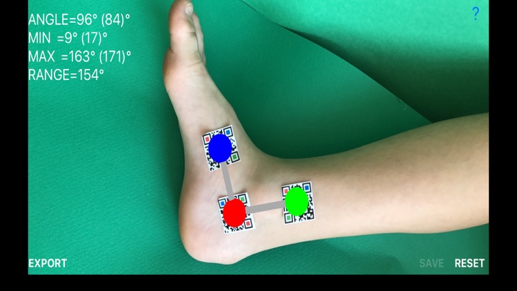 DynamicGoniometerAR