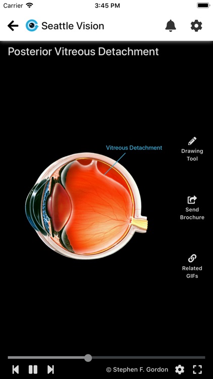 Eye GIFs - Patient Education